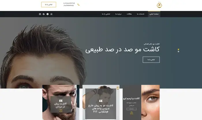 کاشت مو طبیعی دکتر قندالی